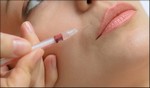 Foto Botox steeds populairder ondanks crisis