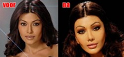 Foto Bollywood in de ban van cosmetische chirurgie