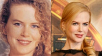 Foto 'Nicole Kidman geeft plastische chirurgie een slechte naam'